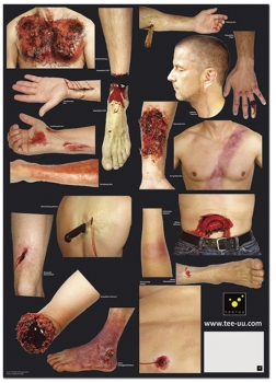 Preview: Verletzungsmuster 36-Tlg